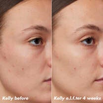 PLZ Clarify Facial Oil, 