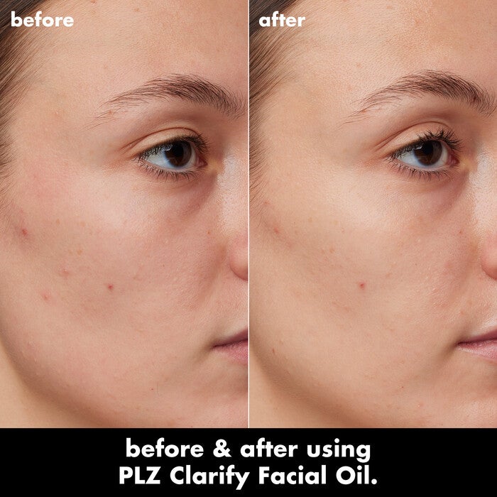 PLZ Clarify Facial Oil, 
