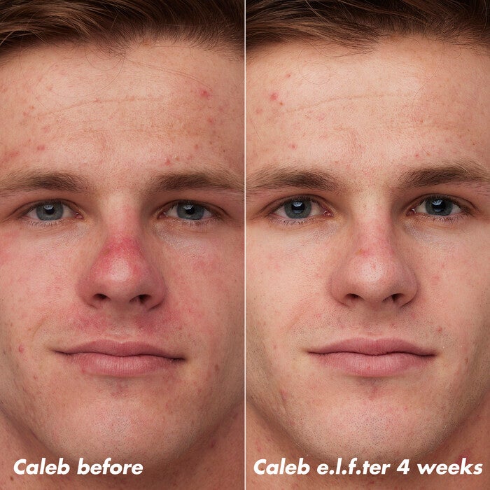 PLZ Clarify Facial Oil, 