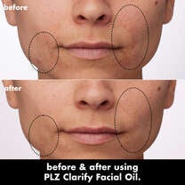 PLZ Clarify Facial Oil, 