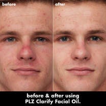 PLZ Clarify Facial Oil, 
