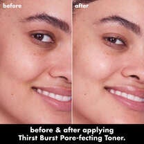 Before and After Using Thirst Burst Pore-fecting Exfoliating Toner