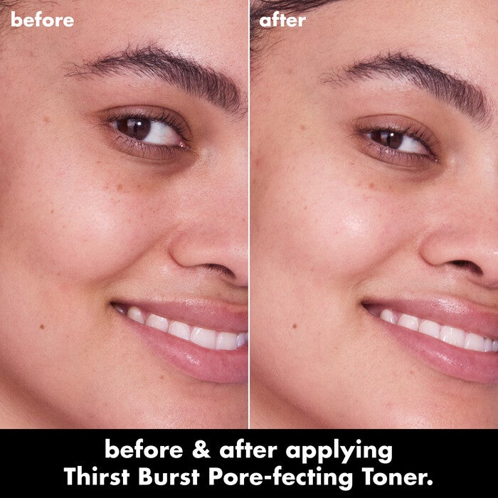 Before and After Using Thirst Burst Pore-fecting Exfoliating Toner