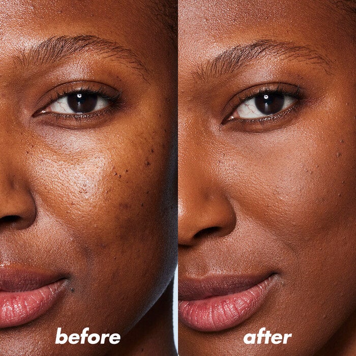 Before and After Using Blue Colour Concealer