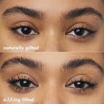 Brow Lift, 
