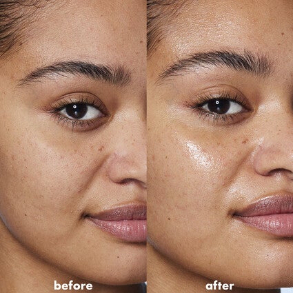 Before and After Application of Face Serum